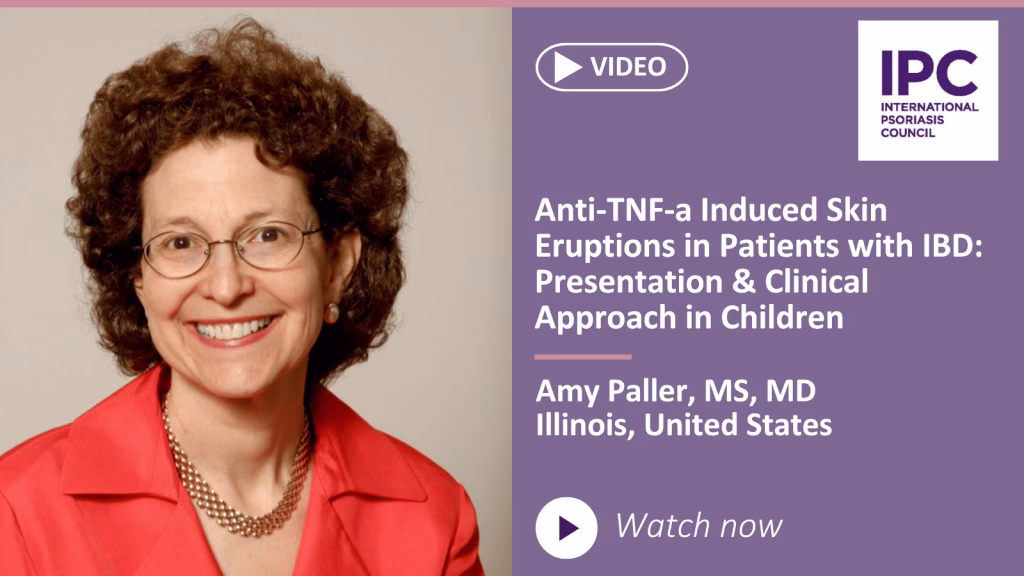 Anti-TNF-a Induced Skin Eruptions in Patients with IBD: Presentation & Clinical Approach in Children